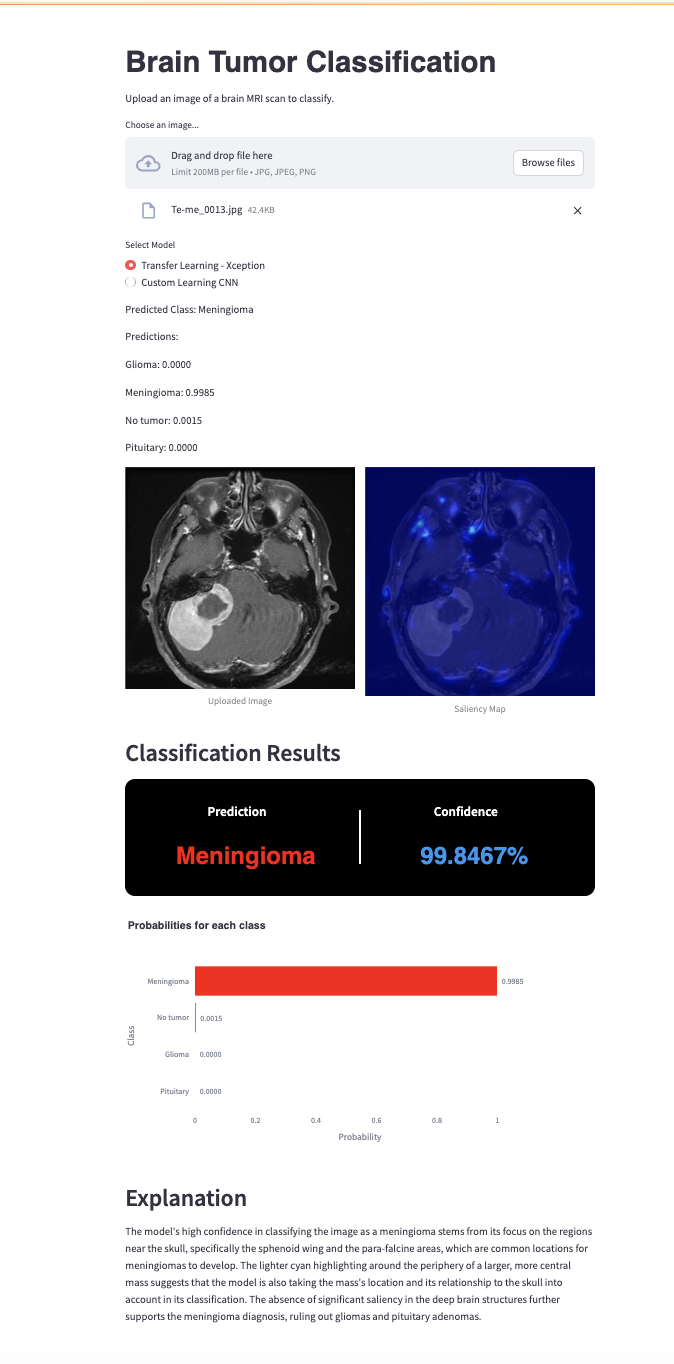 Brain Tumor Classification